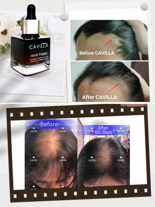 CAVILLA 30mL Hair Tonic Growth Serum Topical Herbal Formula