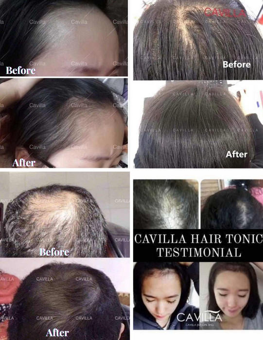 CAVILLA 30mL Hair Tonic Growth Serum Topical Herbal Formula